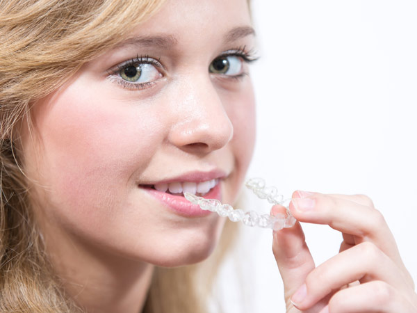 DentistaMED - clinica odontoiatrica Padova - Ortodonzia invisibile