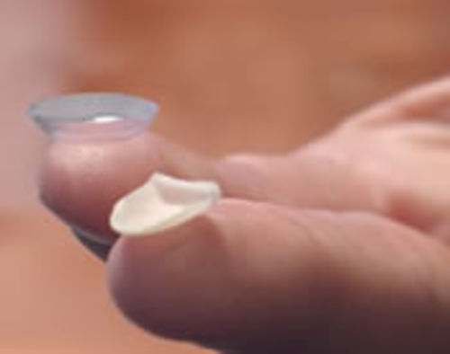 DentistaMED - clinica odontoiatrica Padova - Estetica dentale